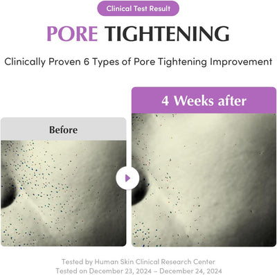 سيروم إيكوالبيري بيربل بي دي آر إن لتقليص المسام